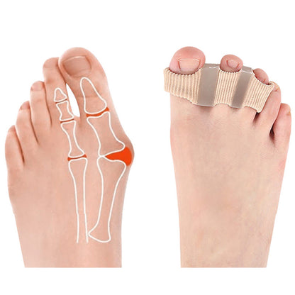 Multi Hole Toe Alignment Support(2 Packs) - image 3